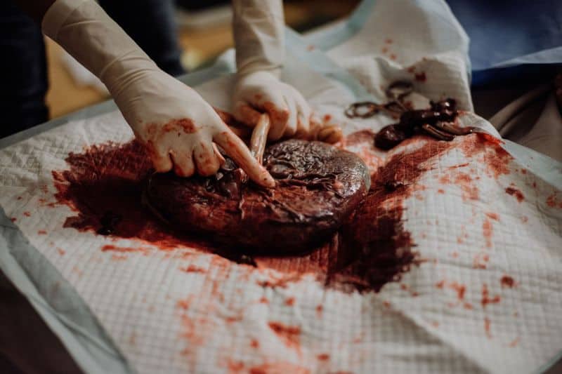 placenta on table after birth